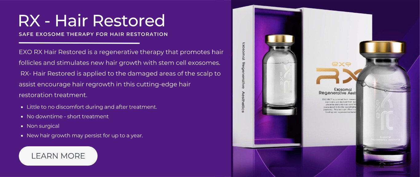 RX Safe Exosome Therapy for Hair Restoration